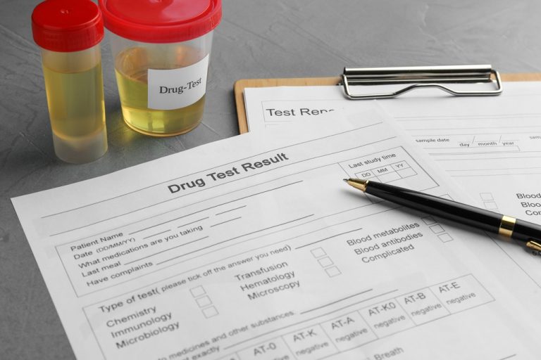 A close-up of a pen on a paper with the words “drug test result” next to two small containers with yellow liquid.